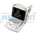 Ультразвукова портативна чорно-біла діагностична система Mindray DP30 | УЗД апарати