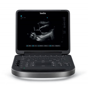 Ультразвукова система SonoSite Edge II