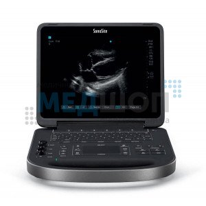 Ультразвуковая система SonoSite Edge II