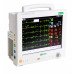 Купить Модульный монитор экспертного класса BM1500 - широкий ассортимент в категории Мониторы пациента | Прикроватные мониторы