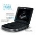 Ультразвукова система SonoSite Edge II | УЗД апарати Ультразвукова система SonoSite Edge II | УЗД апарати