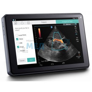 Ультразвуковой аппарат SonoSite iViz Портативный УЗИ - аппарат