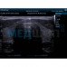 Ультразвуковая портативная черно-белая диагностическая система Mindray DP30 | УЗИ аппараты