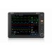 Купити Монітор пацієнта Mindray uMEC10 - широкий асортимент в категорії Монітори пацієнта | Приліжкові монітори