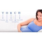 Тест-системы ИФА в Украине | Купить Torch панель - Medshop