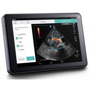 Ультразвуковий апарат SonoSite iViz Портативний УЗД - апарат