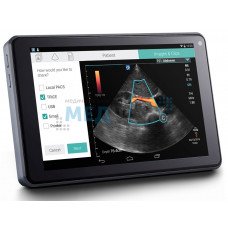 Ультразвуковий апарат SonoSite iViz Портативний УЗД - апарат