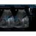 Ультразвуковая портативная черно-белая диагностическая система Mindray DP30 | УЗИ аппараты