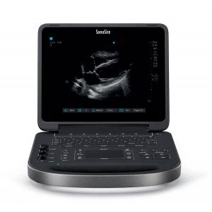 Ультразвукова система SonoSite Edge II
